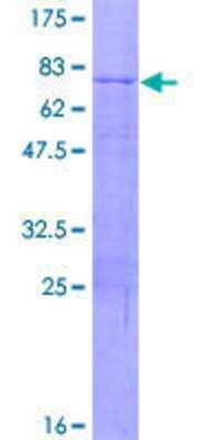 12.5% SDS-PAGE Stained with Coomassie Blue.