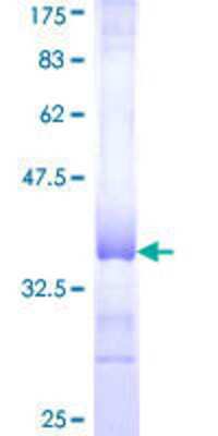 Other Recombinant Human COL16A1 GST (N-Term) Protein