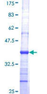 12.5% SDS-PAGE Stained with Coomassie Blue.