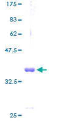 12.5% SDS-PAGE Stained with Coomassie Blue.