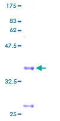 SDS-Page: Recombinant Human Cytochrome C Oxidase subunit 6c Protein [H00001345-P01] - 12.5% SDS-PAGE Stained with Coomassie Blue.