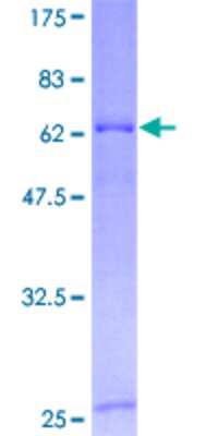 12.5% SDS-PAGE Stained with Coomassie Blue.