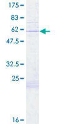 SDS-Page: Recombinant Human COX11 Protein [H00001353-P01] - 12.5% SDS-PAGE Stained with Coomassie Blue.