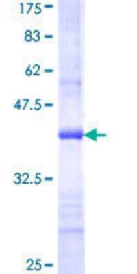 12.5% SDS-PAGE Stained with Coomassie Blue.