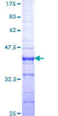 12.5% SDS-PAGE Stained with Coomassie Blue.