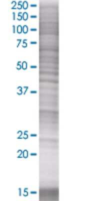 ATF2 transfected lysate.