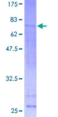 12.5% SDS-PAGE Stained with Coomassie Blue.