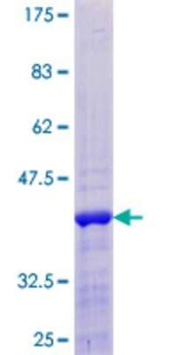 12.5% SDS-PAGE Stained with Coomassie Blue.