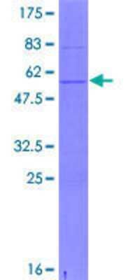 SDS-Page: Recombinant Human CSN3 Protein [H00001448-P01] - 12.5% SDS-PAGE Stained with Coomassie Blue.