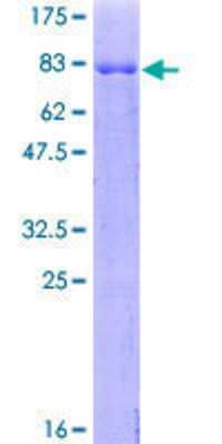 12.5% SDS-PAGE Stained with Coomassie Blue.