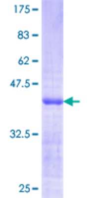 SDS-Page: Recombinant Human CKI gamma 3 Protein [H00001456-Q01] - 12.5% SDS-PAGE Stained with Coomassie Blue.