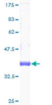 12.5% SDS-PAGE Stained with Coomassie Blue.