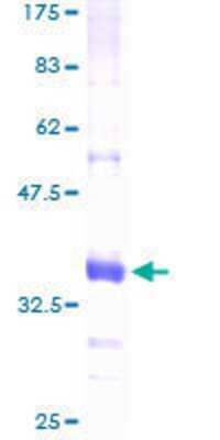 SDS-Page: Recombinant Human Chitobiase/CTBS Protein [H00001486-P01] - 12.5% SDS-PAGE Stained with Coomassie Blue.
