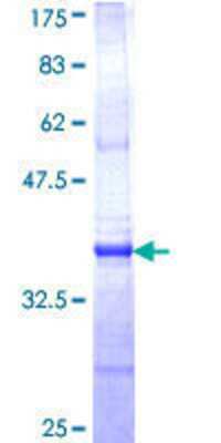 SDS-PAGE Recombinant Human CTNS GST (N-Term) Protein