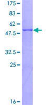 Other Recombinant Human CTRB1 GST (N-Term) Protein