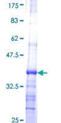 SDS-Page: Recombinant Human CTRB1 Protein [H00001504-Q01] - 12.5% SDS-PAGE Stained with Coomassie Blue.