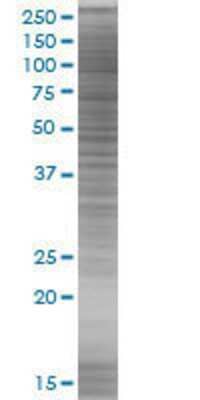 CTSH transfected lysate.