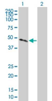 Lane 1: CTSH transfected lysate (36.96 KDa) Lane 2: Non-transfected lysate.