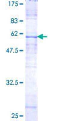 12.5% SDS-PAGE Stained with Coomassie Blue.