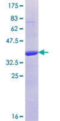 SDS-Page: Recombinant Human Cylicin 1 Protein [H00001538-Q01] - 12.5% SDS-PAGE Stained with Coomassie Blue.