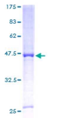 12.5% SDS-PAGE Stained with Coomassie Blue.