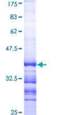 SDS-Page: Recombinant Human CYP11A1 Protein [H00001583-Q01] - 12.5% SDS-PAGE Stained with Coomassie Blue.