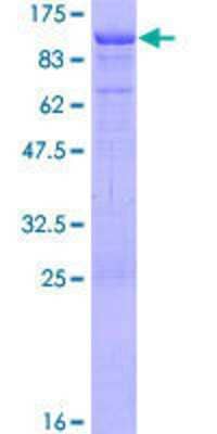 12.5% SDS-PAGE Stained with Coomassie Blue.