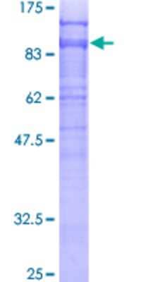 SDS-PAGE Recombinant Human DAB2 GST (N-Term) Protein