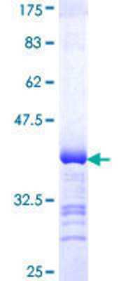 SDS-Page: Recombinant Human DAB2 Protein [H00001601-Q01] - 12.5% SDS-PAGE Stained with Coomassie Blue.