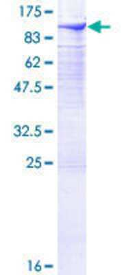 SDS-Page: Recombinant Human DGK-alpha Protein [H00001606-P02] - 12.5% SDS-PAGE Stained with Coomassie Blue.