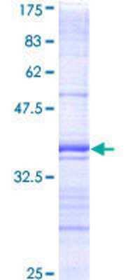 12.5% SDS-PAGE Stained with Coomassie Blue.