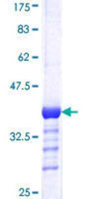 SDS-Page: Recombinant Human DDB1 Protein [H00001642-Q01] - 12.5% SDS-PAGE Stained with Coomassie Blue.