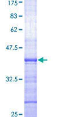 SDS-Page: Recombinant Human XPE/DDB2 Protein [H00001643-Q01] - 12.5% SDS-PAGE Stained with Coomassie Blue.