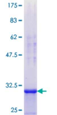 SDS-Page: Recombinant Human DDX3 Protein [H00001654-Q01] - 12.5% SDS-PAGE Stained with Coomassie Blue.