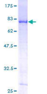 SDS-Page: Recombinant Human DDX6 Protein [H00001656-P01] - 12.5% SDS-PAGE Stained with Coomassie Blue.