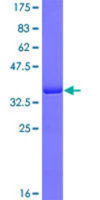 SDS-Page: Recombinant Human DHX8 Protein [H00001659-Q01] - 12.5% SDS-PAGE Stained with Coomassie Blue.