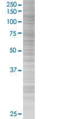 DDX11 transfected lysate.