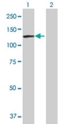 Lane 1: DDX11 transfected lysate (106.81 KDa) Lane 2: Non-transfected lysate.