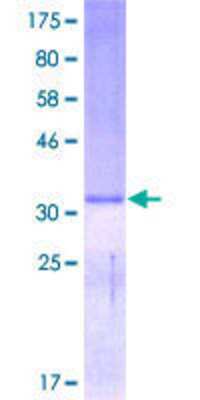SDS-Page: Recombinant Human Defensin alpha 5 Protein [H00001670-P01] - 12.5% SDS-PAGE Stained with Coomassie Blue.