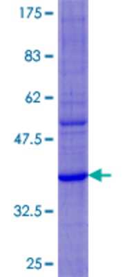 SDS-PAGE Recombinant Human DEFA6 GST (N-Term) Protein