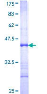 12.5% SDS-PAGE Stained with Coomassie Blue.