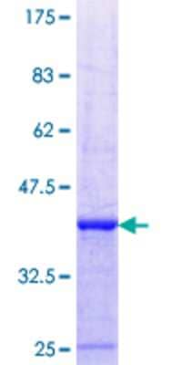 SDS-PAGE Recombinant Human Dfna5 GST (N-Term) Protein