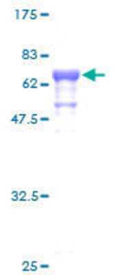 SDS-PAGE Recombinant Human Septin-1 GST (N-Term) Protein