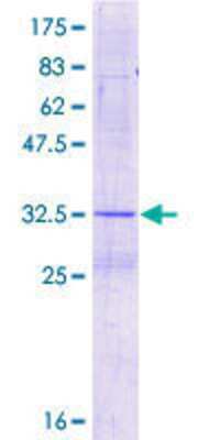 12.5% SDS-PAGE Stained with Coomassie Blue.