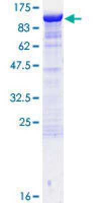 12.5% SDS-PAGE Stained with Coomassie Blue.