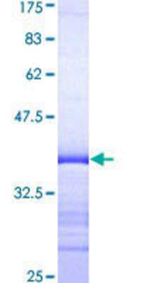 SDS-Page: Recombinant Human BP1 Protein [H00001748-Q01] - 12.5% SDS-PAGE Stained with Coomassie Blue.