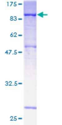 12.5% SDS-PAGE Stained with Coomassie Blue.