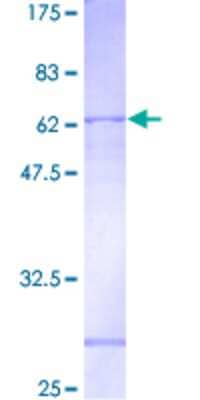 12.5% SDS-PAGE Stained with Coomassie Blue.