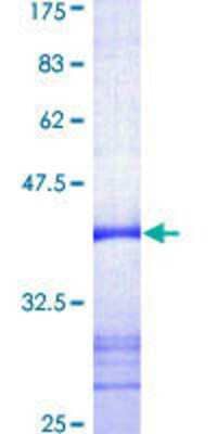 SDS-Page: Recombinant Human TdT Protein [H00001791-Q01] - 12.5% SDS-PAGE Stained with Coomassie Blue.