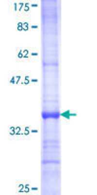 12.5% SDS-PAGE Stained with Coomassie Blue.
